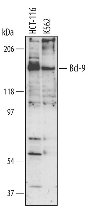 Detection of Human Bcl‑9 antibody by Western Blot.