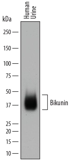 Detection of Human Bikunin antibody by Western Blot.