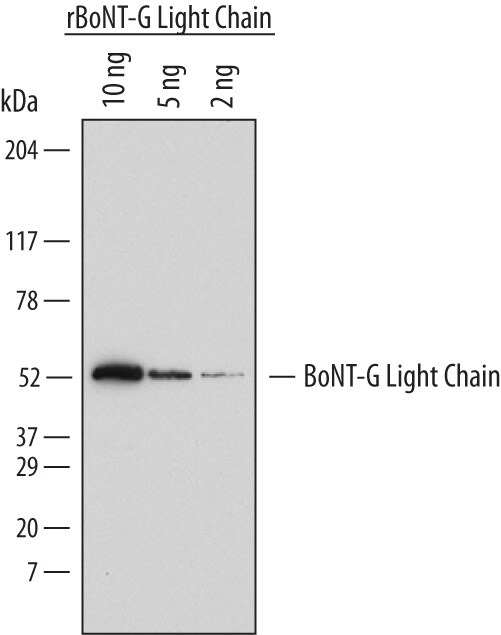 Detection ofC. botulinumBoNT-G Light Chain antibody by Western Blot.