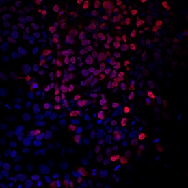 Brachyury antibody in BG01V Human Stem Cells by Immunocytochemistry (ICC).
