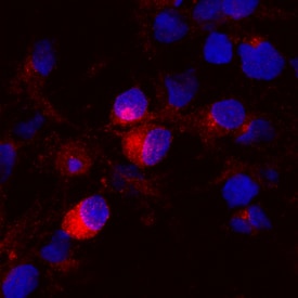 Brevican antibody in Rat Cortical Stem Cells by Immunocytochemistry (ICC).