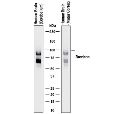 Detection of Human Brevican antibody by Western Blot.