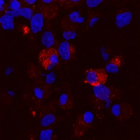 Brevican antibody in Rat Cortical Stem Cells by Immunocytochemistry (ICC).