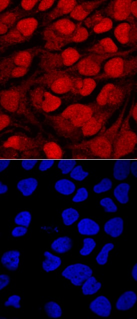 Brg1 antibody in HeLa Human Cell Line by Immunocytochemistry (ICC).