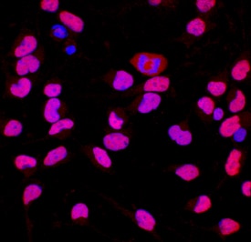 Brg1 antibody in Rat Cortical Stem Cells by Immunocytochemistry (ICC).