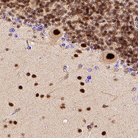 Brg1 antibody in Human Brain by Immunohistochemistry (IHC-P).