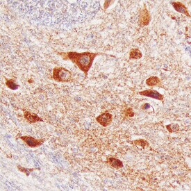 Brorin/VWC2 antibody in Human Brain by Immunohistochemistry (IHC-P).