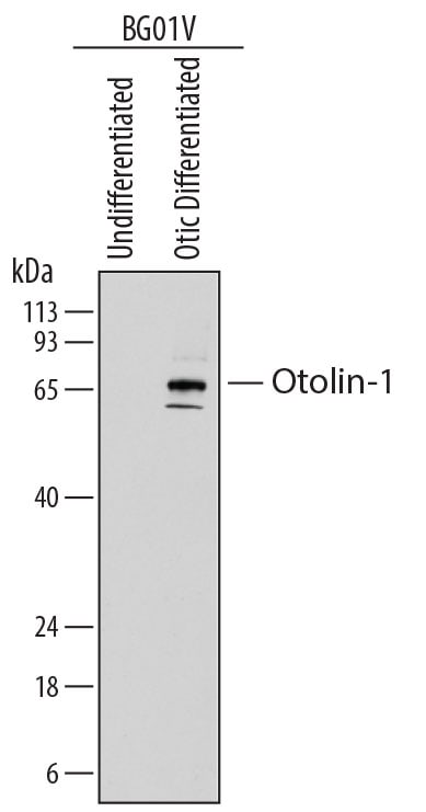 Detection of Human Otolin-1 antibody by Western Blot.