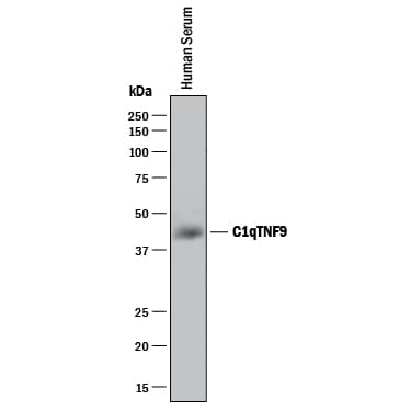 Detection of Human CTRP9/C1qTNF9 antibody by Western Blot.