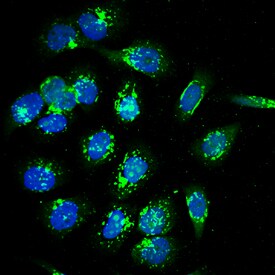 Calcium Activated Nucleotidase 1/CANT1 antibody in PC-3 Human Cell Line by Immunocytochemistry (ICC).
