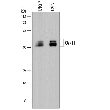 Detection of Human Calcium Activated Nucleotidase 1/CANT1 antibody by Western Blot.