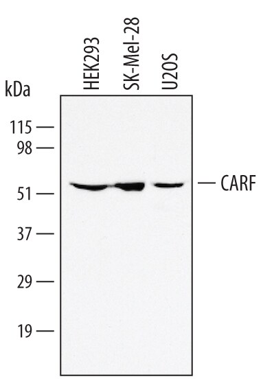 Detection of Human CARF antibody by Western Blot.