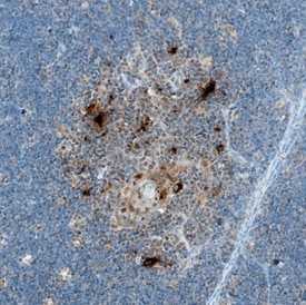 CCL17/TARC antibody in Human Spleen by Immunohistochemistry (IHC-P).