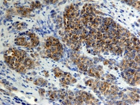 CCL20/MIP‑3a antibody in Human Lymph Node by Immunohistochemistry (IHC-P).
