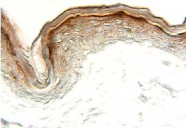 CCL24/Eotaxin-2/MPIF-2 antibody in Human Skin by Immunohistochemistry (IHC-P).