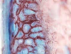 CCL27/CTACK antibody in Human Skin by Immunohistochemistry (IHC-Fr).