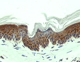 CCL27/CTACK antibody in Mouse Skin by Immunohistochemistry (IHC-Fr).