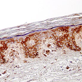 CCL27/CTACK antibody in Human Skin by Immunohistochemistry (IHC-P).