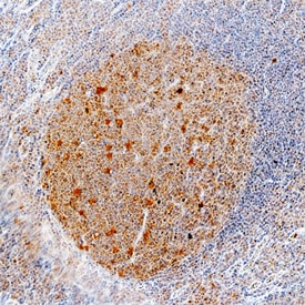 CCL3/MIP-1a antibody in Human Tonsil by Immunohistochemistry (IHC-P).
