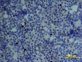 CCL4/MIP-1 beta  antibody in Mouse Spleen by Immunohistochemistry (IHC-Fr).