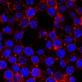 CCR2 antibody in RAW 264 by Immunocytochemistry (ICC).7 Mouse Cell Line by Immunocytochemistry (ICC).