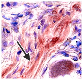 CCR5 antibody in Human Dorsal Root Ganglia by Immunohistochemistry (IHC-P).