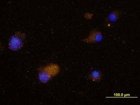 CCR5 antibody in Human Dendritic Cells by Immunocytochemistry (ICC).