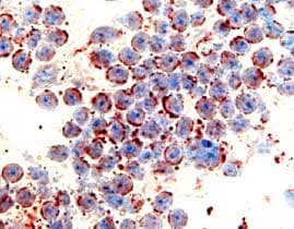 CCR6 antibody in Human Spleen by Immunohistochemistry (IHC-P).