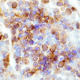 CCR6 antibody in Mouse Spleen by Immunohistochemistry (IHC-Fr).