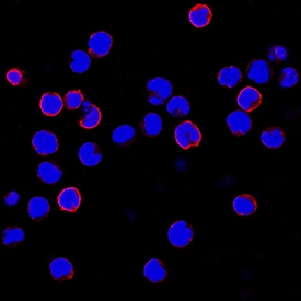 CCR9 antibody in MOLT-4 Human Cell Line by Immunocytochemistry (ICC).