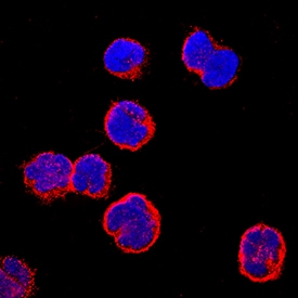 CCR9 antibody in MOLT-4 Human Cell Line by Immunocytochemistry (ICC).