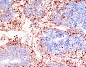 CD14 antibody in Human Lymph Node by Immunohistochemistry (IHC-P).