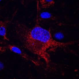 CD151 antibody in bEnd by Immunocytochemistry (ICC).3 Mouse Cell Line by Immunocytochemistry (ICC).