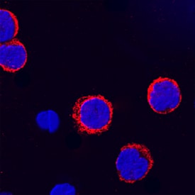 CD155/PVR antibody in Human PBMCs by Immunocytochemistry (ICC).