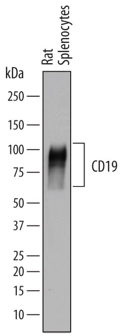 Detection of Rat CD19 antibody by Western Blot.