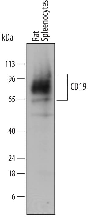 Detection of Rat CD19 antibody by Western Blot.