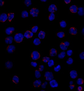 CD1a antibody in MOLT-4 Human Cell Line by Immunocytochemistry (ICC).