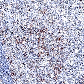 CD27/TNFRSF7 antibody in Human Tonsil by Immunohistochemistry (IHC-P).