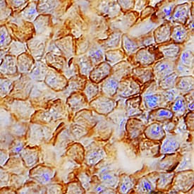 TMIGD2/CD28H antibody in Human Thymus by Immunohistochemistry (IHC-P).