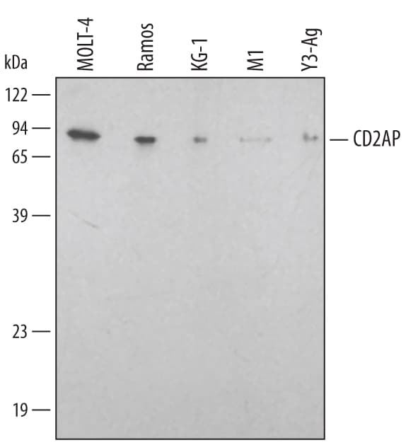 Detection of Human/Mouse/Rat CD2AP antibody by Western Blot.