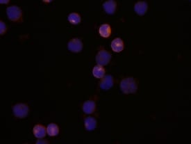CD2 antibody in Human PBMCs by Immunocytochemistry (ICC).