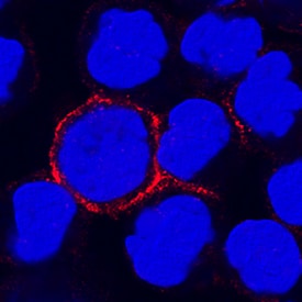 CD300f/LMIR3 antibody in Human PBMCs by Immunocytochemistry (ICC).
