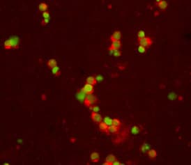 CD30/TNFRSF8 antibody in Mouse Splenocytes by Immunocytochemistry (ICC).