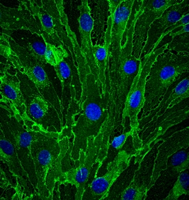 CD31/PECAM-1 antibody in bEnd by Immunocytochemistry (ICC).3 Mouse Cell Line by Immunocytochemistry (ICC).