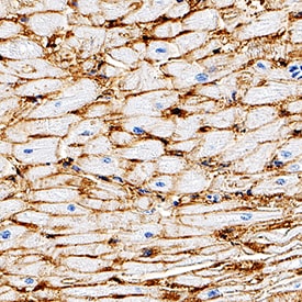 CD36/SR-B3 antibody in Human Heart by Immunohistochemistry (IHC-P).