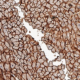 CD36/SR-B3 antibody in Human Heart by Immunohistochemistry (IHC-P).
