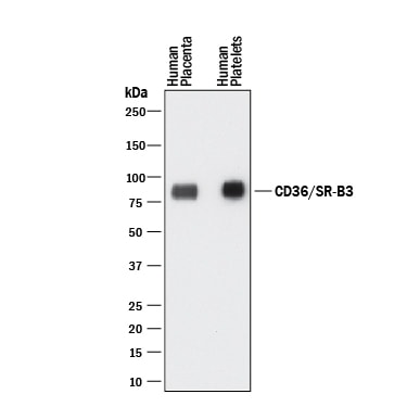 Detection of Human CD36/SR-B3 antibody by Western Blot.