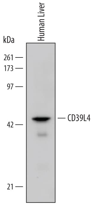Detection of Human CD39L4/ENTPD5 antibody by Western Blot.