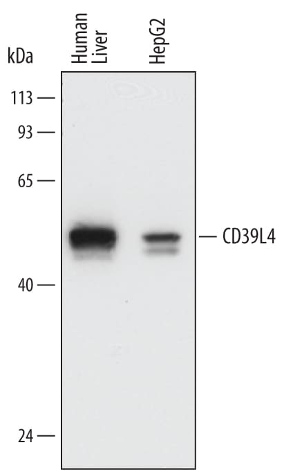 Detection of Human CD39L4/ENTPD5 antibody by Western Blot.