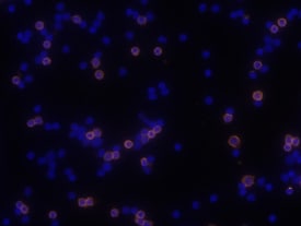 CD40/TNFRSF5 antibody in Mouse Splenocytes by Immunocytochemistry (ICC).